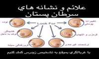 تشخیص زود هنگام سرطان پستان
