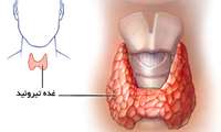 بيماري هاي اتو ايميون ، دليل بيشتر اختلالات تيروئيدی