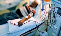 ارائه خدمات دیالیزی به بیش از 7 هزار بیمار طی 9 ماه